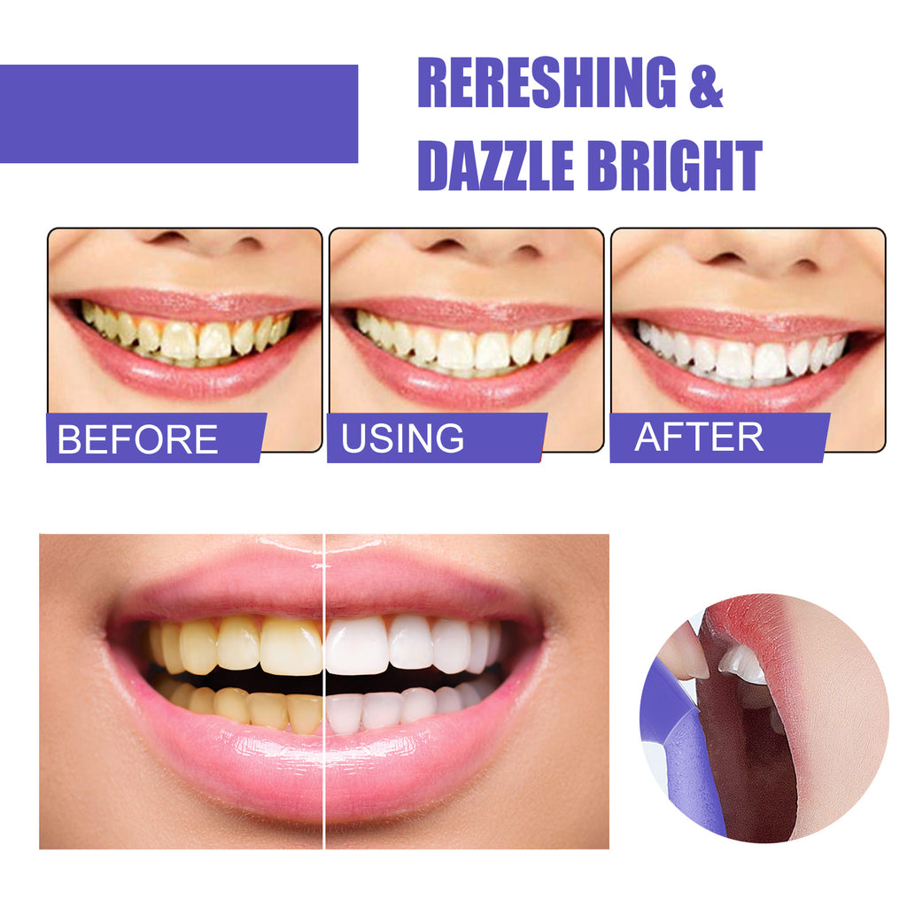 Foaming Whitening Toothpaste Toothpaste To Clean Tartar Stains, Freshen Breath And Whiten Teeth